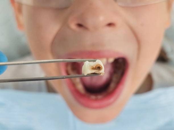 Best Emergency Broken Tooth Repair in Hickman, NE